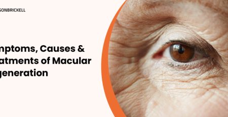 Eyes on brickell: Symptoms, Causes And Treatments Of Macular Degeneration