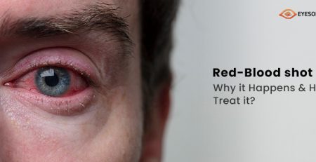 Eyes on Brickell: Red-Bloodshot Eyes: Why It Happens & How To Treat It?