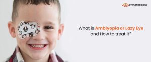 Eyes on Brickell - What Is Amblyopia Or Lazy Eye And How To Treat It
