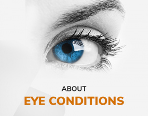 Eyes on Brickell: About - Eye-conditions