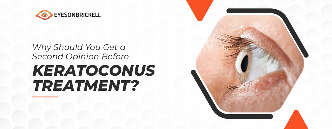 Eyes On Brickell: Why Should You Get a Second Opinion Before Keratoconus Treatment